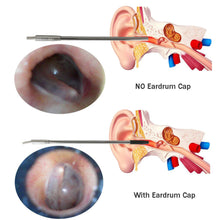 Учитај слику у прегледач галерије, ВиФи ендоскоп 4,9 мм сочиво ухо нос медицински бороскоп инспекција отоскоп камера