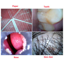 Учитај слику у прегледач галерије, ВиФи ендоскоп 4,9 мм сочиво ухо нос медицински бороскоп инспекција отоскоп камера